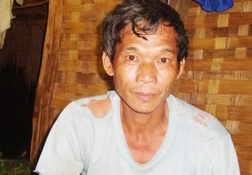 Thầy lang xứ Mường - Kỳ 3: “Thần y” chữa bỏng ảnh 3