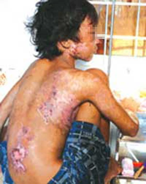 Bé 14 tuổi bị chủ bẻ răng, kẹp sứt môi, đánh dã man ảnh 1