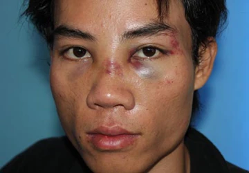 Nhà xe vác dao tra tấn khách như thời trung cổ ảnh 1