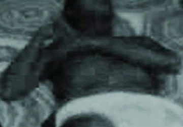 Từ “cái chết trắng” của tiền vệ Molina: Báo động về công tác quản lý ảnh 2