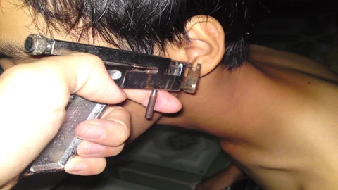 Rùng mình chuyện dùng súng bấm lỗ … “chỗ ấy” ảnh 1