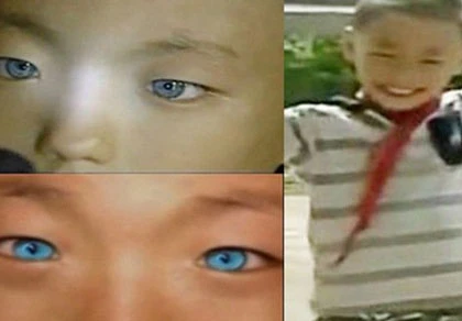 Cậu bé có "đôi mắt mèo" nhìn xuyên thấu màn đêm ảnh 1