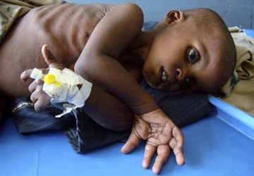 Thảm họa thiếu lương thực đe dọa châu Phi ảnh 1 Thảm họa thiếu lương thực đe dọa châu Phi ảnh 1