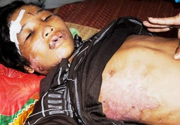 Vụ em trai 14 tuổi bị hành hạ dã man ở Cà Mau: Chủ trại tôm quá độc ác! ảnh 1 Vụ em trai 14 tuổi bị hành hạ dã man ở Cà Mau: Chủ trại tôm quá độc ác! ảnh 1