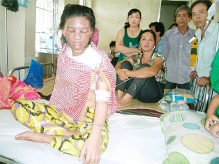 Chồng nhẫn tâm tạt cả nồi nước sôi lên người vợ ảnh 1