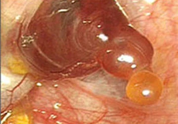 Phụ nữ được sở hữu bao nhiêu trứng trong đời? ảnh 1