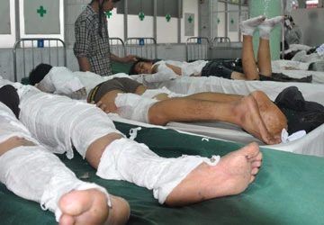 Nổ ở xưởng gỗ, 21 người bỏng nặng ảnh 1