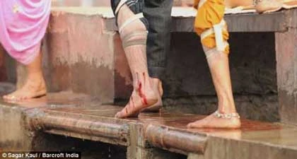 Xếp hàng dài để được rạch chân, tay ảnh 1 Xếp hàng dài để được rạch chân, tay ảnh 1