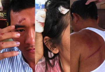 Cả gia đình bị côn đồ truy sát giữa đường ảnh 1