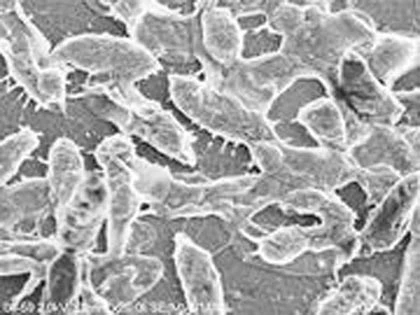 Nữ sinh mất tay chân vì vi khuẩn ăn thịt người ảnh 2