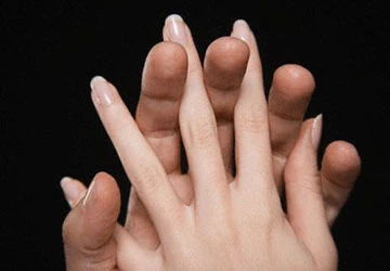 Bí mật nơi bàn tay các quý ông ảnh 1