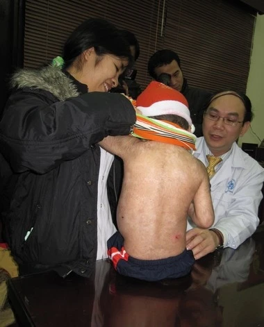 Em bé Việt Nam đầu tiên khỏi bệnh 'lột da ếch' nhờ ghép tủy ảnh 1