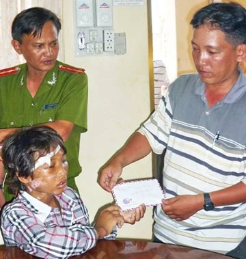 Vụ em trai 14 tuổi bị hành hạ ở Cà Mau: Ký ức tuổi thơ quá buồn… ảnh 4 Vụ em trai 14 tuổi bị hành hạ ở Cà Mau: Ký ức tuổi thơ quá buồn… ảnh 4