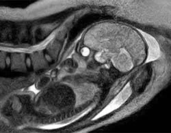 Ảnh scan đầu tiên trên thế giới về giây phút bé chào đời ảnh 1