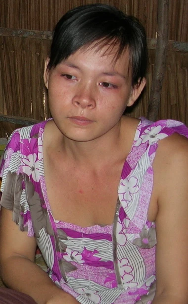 Bé 5 tuổi bị mẹ kế đánh nhập viện ảnh 2