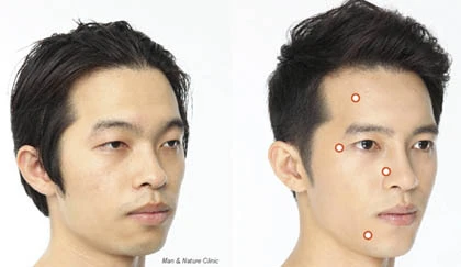 Đàn ông Hàn nô nức làm đẹp trên bàn mổ ảnh 1 Đàn ông Hàn nô nức làm đẹp trên bàn mổ ảnh 1