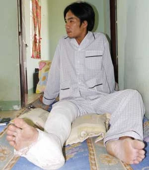 Công an xã đánh gãy chân người ảnh 1