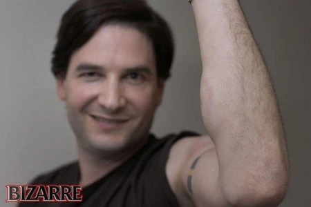 Người đàn ông “nghiện” tiêm nọc độc rắn vào người ảnh 4