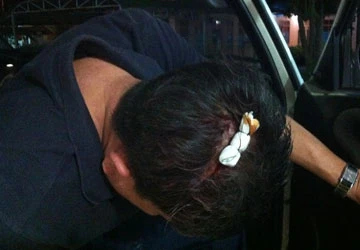 Côn đồ đánh bảo vệ bệnh viện trọng thương ảnh 1