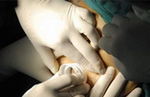 Giật mình vì nhũ hoa mới của vợ ảnh 1