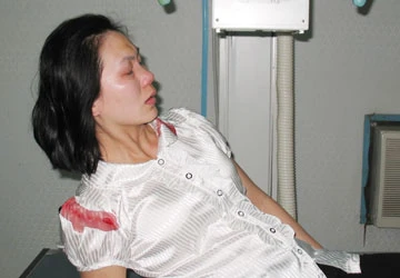 Bị học sinh đánh, một cô giáo đi cấp cứu ảnh 1