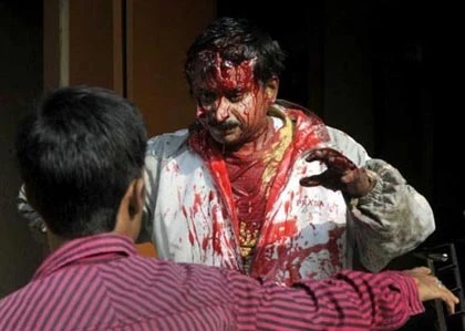 Báo lạc vào khu dân cư tấn công người ảnh 2 Báo lạc vào khu dân cư tấn công người ảnh 2