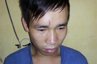 Sát hại "tình địch" vì tự ti xấu trai ảnh 1