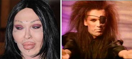 Hóa "Ngáo ộp" vì phẫu thuật thẩm mỹ ảnh 6