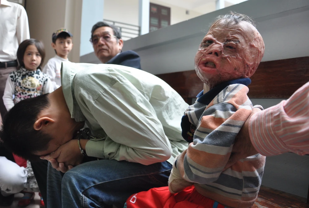 Chùm ảnh: Phiên tòa xét xử người cha nhẫn tâm đốt con mới ba tuổi ảnh 2