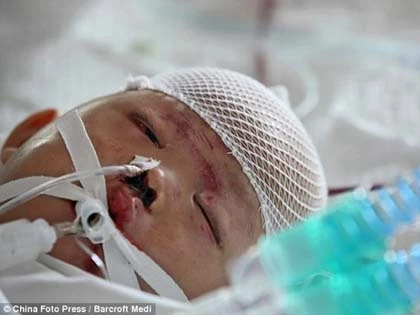 Trung Quốc: Bé 5 tuổi bị cố tình cán 2 lần ảnh 3