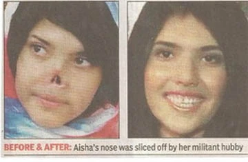 Cô gái bị Taliban cắt mũi đã lấy lại vẻ đẹp xưa ảnh 1