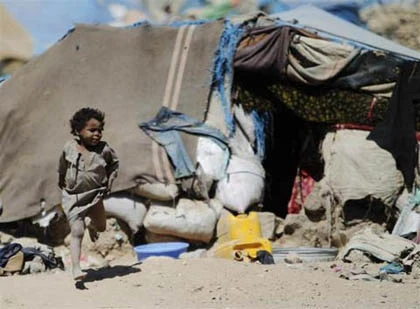Những đứa trẻ teo tóp đáng thương ở Yemen ảnh 7
