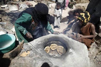 Những đứa trẻ teo tóp đáng thương ở Yemen ảnh 8