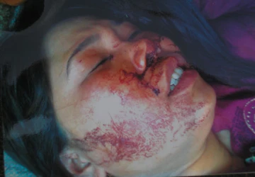 Bắt tạm giam một đối tượng trong vụ vợ chủ tịch xã đánh ghen ảnh 1