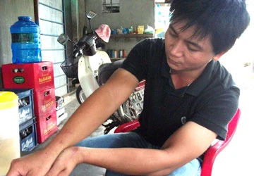 Khỉ tấn công, hơn 10 người bị thương ảnh 1