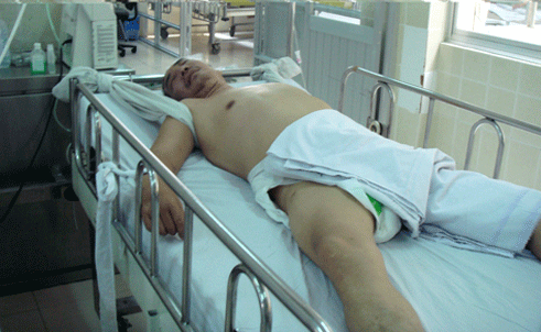 Nghệ sĩ cải lương Vương Cảnh bị đánh hội đồng? ảnh 2