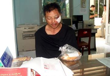 Chưa tìm thấy số vàng bị cướp ở Bình Thuận ảnh 1