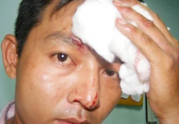 Khởi tố kẻ hành hung phóng viên báo Người Lao Động ảnh 1