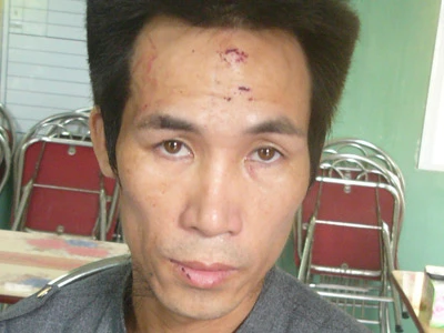 Bắt đối tượng có 3 lệnh truy nã ảnh 1