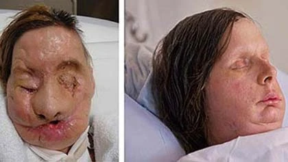 Chuyện của người đàn bà bị tinh tinh xé nát mặt ảnh 2