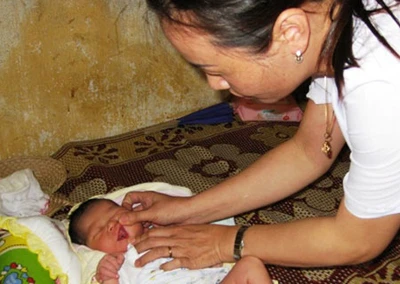 Một bé trai sinh ra đã mọc 2 răng sữa ảnh 1 Một bé trai sinh ra đã mọc 2 răng sữa ảnh 1