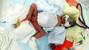 Thai phụ không biết có thai sinh con 600g ảnh 1