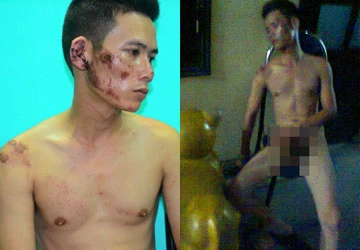 Say rượu bị lột truồng, còng tay ảnh 1