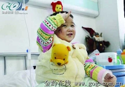 Bố cắn đứt ngón tay con lúc say rượu ảnh 1 Bố cắn đứt ngón tay con lúc say rượu ảnh 1