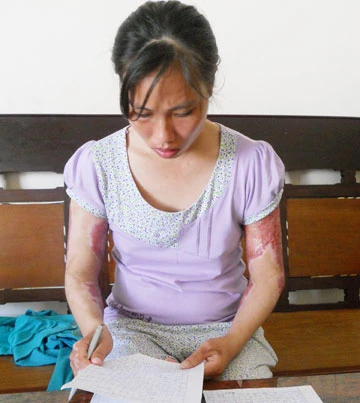 Bị chồng đốt, vợ xin bãi nại ảnh 1