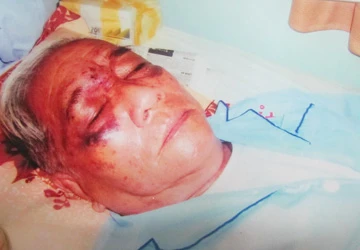 Cụ ông 71 tuổi bị vợ bạo hành ảnh 1