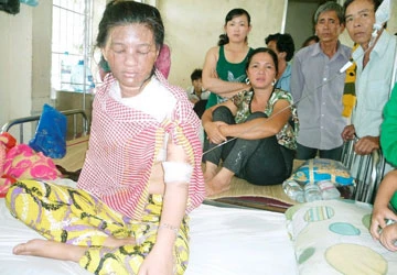 Người chồng tạt nước sôi vợ đã ra đầu thú ảnh 1