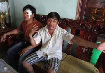 Bị “giang hồ” ném đá để đòi nợ ảnh 1