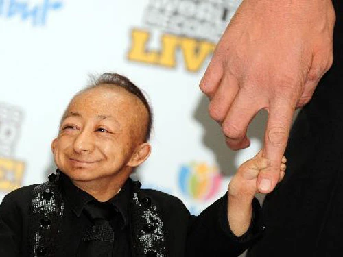 Người lùn nhất thế giới đột ngột qua đời ảnh 1