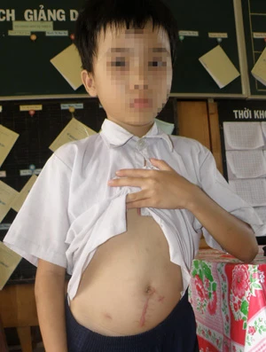 Thực hư việc một bé trai bị bạo hành ảnh 1